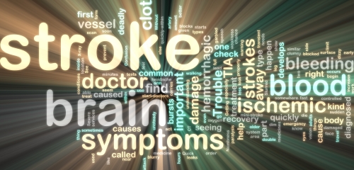 Signs of Stroke in Men and Women